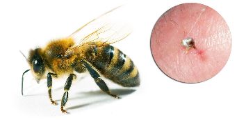 ส่วนหนึ่ง Hondrostrong รษผึ้งซึ่งทำให้ดีขึ้นเรื่องเกี่ยวกับการเผาผลาโพรเซสในทิชชู่